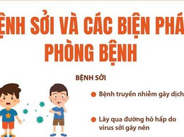 Hà Nội triển khai chiến dịch tiêm vaccine sởi cho trẻ từ 1 - 5 tuổi