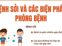 Bệnh sởi và các biện pháp phòng bệnh