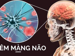 Khuyến cáo phòng chống dịch bệnh Viêm não mô cầu
