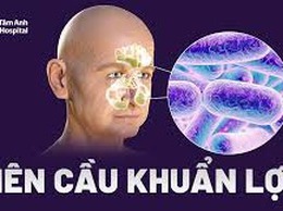 TUYÊN TRUYỀN BỆNH LIÊN CẦU LỢN LÂY CHO NGƯỜI VÀ CÁC BIỆN PHÁP PHÒNG TRÁNH
