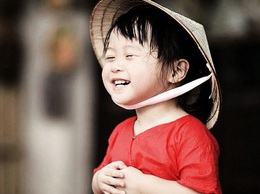 CHƯƠNG TRÌNH PHẪU THUẬT DỊ TẬT VÙNG HÀM MẶT TẠI BỆNH VIỆN TRUNG ƯƠNG QUÂN ĐỘI 108