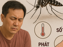 Bệnh chikungunya: Những thông tin có thể bạn chưa biết
