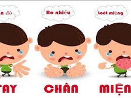 CÁCH PHÒNG, CHỐNG BỆNH TAY CHÂN MIỆNG