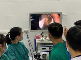 Bệnh viện Đa khoa huyện Thường Tín: Gắp thành công dị vật bàn chải đánh răng trong dạ dày bằng nội soi gây mê