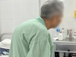 Phẫu thuật đặc biệt cho bệnh nhân ung thư dạ dày bị gù vẹo cột sống nặng