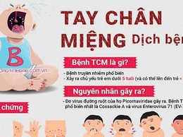 BỆNH TAY CHÂN MIỆNG VÀ NHỮNG ĐIỀU CẦN BIẾT
