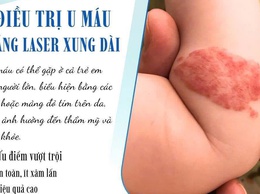 Bệnh viện Da liễu Hà Nội triển khai điều trị u máu bằng Laser xung dài