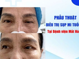 Bệnh viện Mắt Hà Nội phẫu thuật thành công nhiều ca sụp mi tuổi già