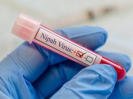 Dịch bệnh do vi rút Nipah và khuyến cáo của ngành y tế