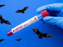 Tăng cường giám sát phòng, chống dịch bệnh do vi rút Nipah