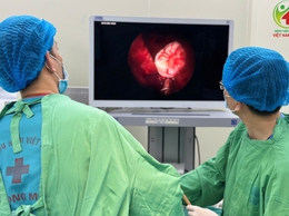 Những biến chứng răng mọc lạc chỗ vào xoang hàm