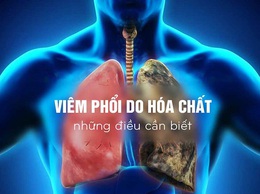 Xử trí đúng khi trẻ uống nhầm xăng, dầu