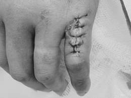 Bệnh viện Đa khoa Hòe Nhai khuyến cáo: Tận dụng 