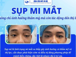 Cần phát hiện và can thiệp sớm sụp mi để tránh ảnh hưởng đến thị lực