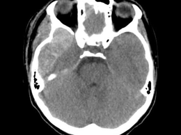 Bệnh viện đa khoa Hà Đông - cuộc đua giành lại sự sống cho bệnh nhân 14 tuổi