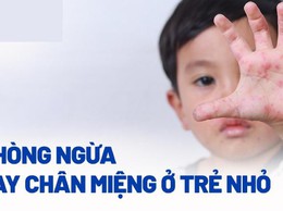 Chủ động phòng, chống bệnh tay chân miệng ở trẻ em 
