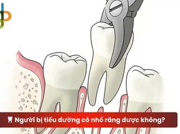 Có nên trì hoãn nhổ răng ở người mắc bệnh tiểu đường?