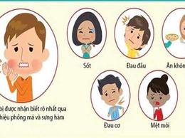 Các biện pháp phòng, chống bệnh quai bị