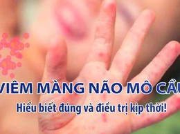 NHỮNG ĐIỀU CẦN BIẾT VỀ BỆNH VIÊM MÀNG NÃO DO NÃO MÔ CẦU