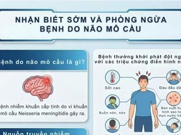 Nhận biết sớm và phòng ngừa bệnh do não mô cầu