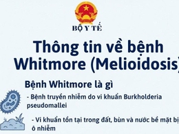 CẢNH GIÁC VỚI BỆNH WHITMORE (MELIOIDOSIS)
