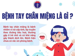 Các biện pháp phòng chống tay chân miệng