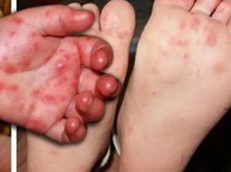 Tổ chức đợt cao điểm “Vệ sinh môi trường, khử khuẩn chủ động phòng, chống bệnh Tay chân miệng” trên địa bàn xã đợt tháng 3, 4 năm 2026