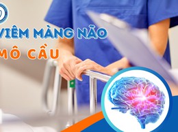 Phòng chống bệnh viêm màng não do não mô cầu