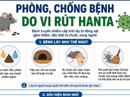  PHÒNG CHỐNG BỆNH DO VI RÚT HANTA
