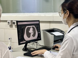 5 trường hợp cần tầm soát ung thư phổi