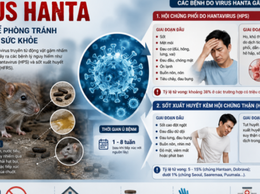 Khuyến cáo các biện pháp phòng, chống dịch bệnh do vi rút Hanta và các bệnh dịch khác lây truyền từ chuột sang người