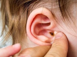 Cần phát hiện sớm, điều trị kịp thời viêm tai giữa để bảo vệ thính lực và sự phát triển của trẻ