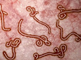 Tăng cường giám sát và phòng, chống bệnh do Ebola vi rút