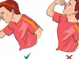 Cần xử trí chảy máu cam đúng cách để tránh biến chứng
