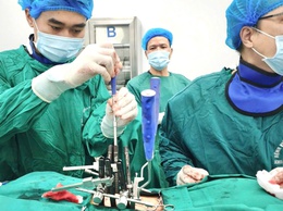Mổ bắt vít cột sống qua da: Giải pháp hiện đại cho người đau lưng kéo dài
