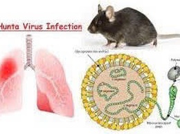 Phòng chống bệnh do Virus Hanta