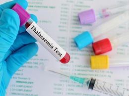 Thalassemia – bệnh di truyền nguy hiểm nhưng hoàn toàn có thể phòng ngừa