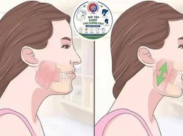 Đừng chủ quan với cơn đau hàm mặt kéo dài