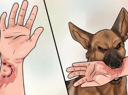 CHỦ ĐỘNG PHÒNG, CHỐNG BỆNH DẠI – BẢO VỆ SỨC KHỎE GIA ĐÌNH VÀ CỘNG ĐỒNG