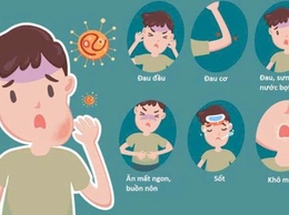 Nhận biết sớm bệnh quai bị để phòng ngừa biến chứng và hạn chế lây lan trong cộng đồng