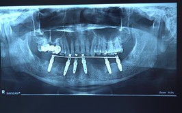 Thực trạng sức khỏe răng miệng cần được quan tâm đúng mức