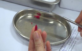 Triển khai uống VitaminA trên toàn thành phố