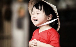 CHƯƠNG TRÌNH PHẪU THUẬT DỊ TẬT VÙNG HÀM MẶT TẠI BỆNH VIỆN TRUNG ƯƠNG QUÂN ĐỘI 108