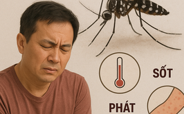 Bệnh chikungunya: Những thông tin có thể bạn chưa biết