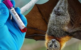 Bộ Y tế hỏa tốc yêu cầu siết chặt phòng dịch do virus Nipah