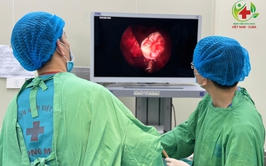 Những biến chứng răng mọc lạc chỗ vào xoang hàm