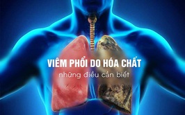 Xử trí đúng khi trẻ uống nhầm xăng, dầu