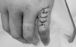 Bệnh viện Đa khoa Hòe Nhai khuyến cáo: Tận dụng 