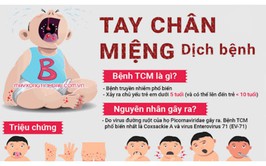 Dấu hiệu nhận biết bệnh Tay chân miệng