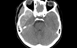 Bệnh viện đa khoa Hà Đông - cuộc đua giành lại sự sống cho bệnh nhân 14 tuổi